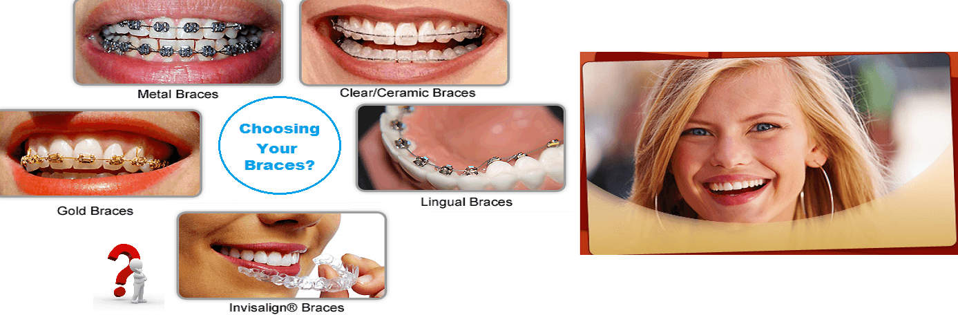 braces in Dubai UAE - BEST Orthodontist & Dentist in Dubai UAE for